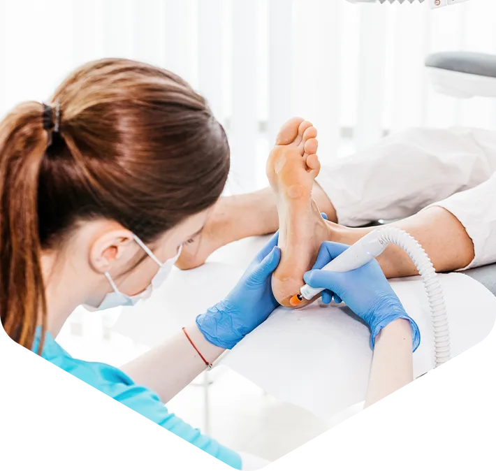 Podolog FootMedica opracowuje zmianę na stopie w gabinecie